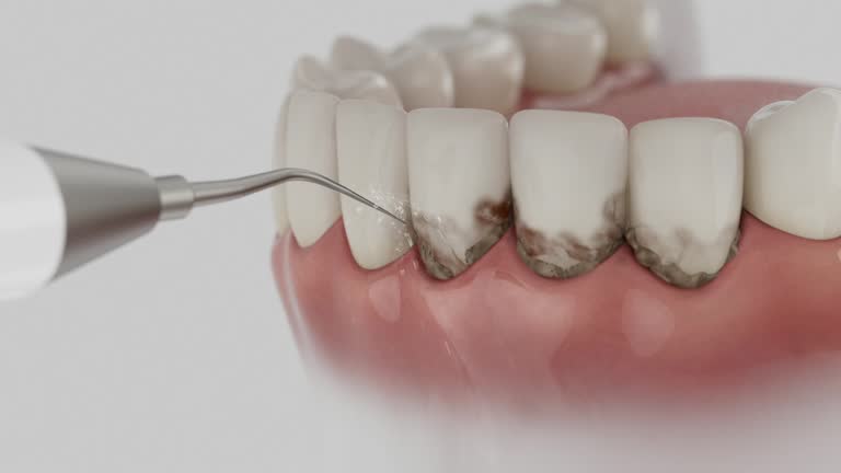 Trusted Dental Crowns And Bridges service in Lacombe, LA - Dentist Open Now